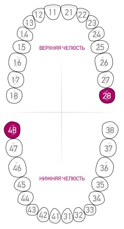 Кламп для коффердама Dentech (Япония) 12А